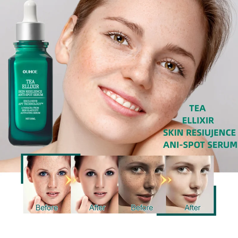 TEA ELLIXIR SKIN RESIUJENCE ANI-SPOT SERUM For Face Skin Brightening Reduce Wrinkles Fine Lines Shrink Pores Facial Skin Care
TEA ELLIXIR SKIN RESIUJENCE ANI-SPOT SERUM For Face Skin Brightening Reduce Wrinkles Fine Lines Shrink Pores Facial Skin Care