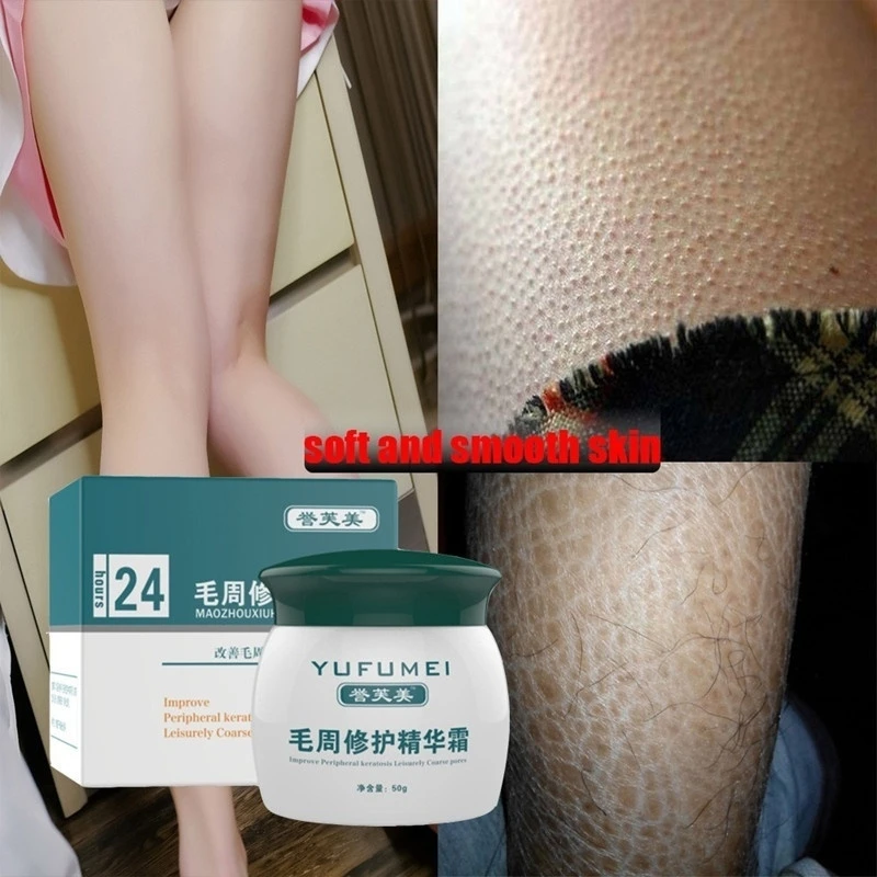 Face & Body Skin Repair Cream Lotion for Curing Keratosis Pilaris/ KP/ Chicken Skin CR9
Face & Body Skin Repair Cream Lotion for Curing Keratosis Pilaris/ KP/ Chicken Skin CR9