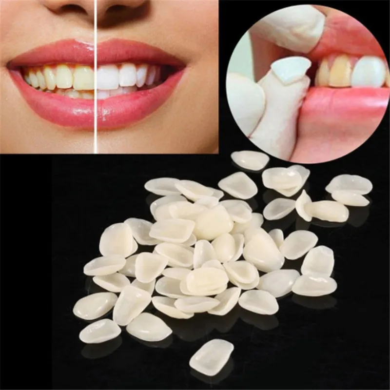 

70 шт. стоматологические ультратонкие виниры для отбеливания смолы фарфоровые материалы временные зубы верхние передние отбеливающие Стом...