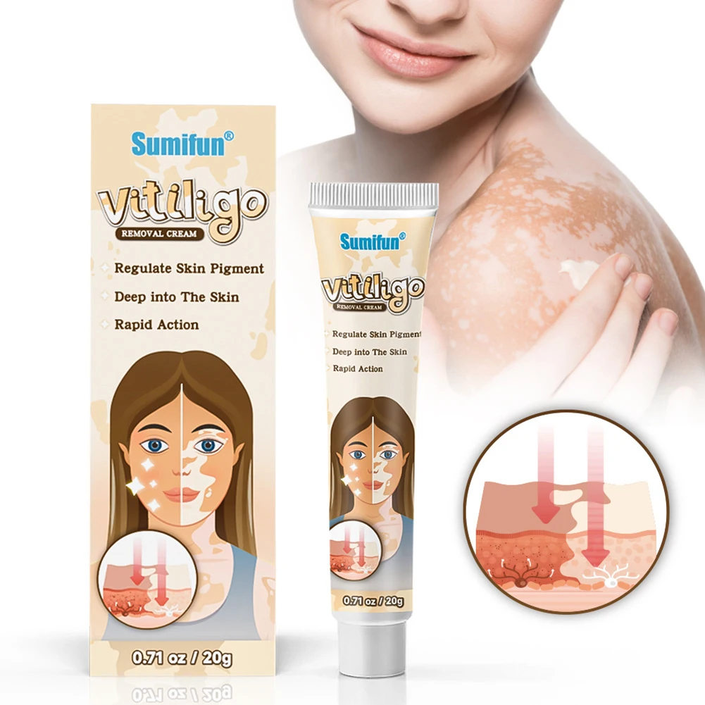 20g Body Face Vitiligo Removal Cream Natural White Spot Treatment Ointment Fast Acting Leukoplakia Vitiligo Cream Health Care
20g Body Face Vitiligo Removal Cream Natural White Spot Treatment Ointment Fast Acting Leukoplakia Vitiligo Cream Health Care