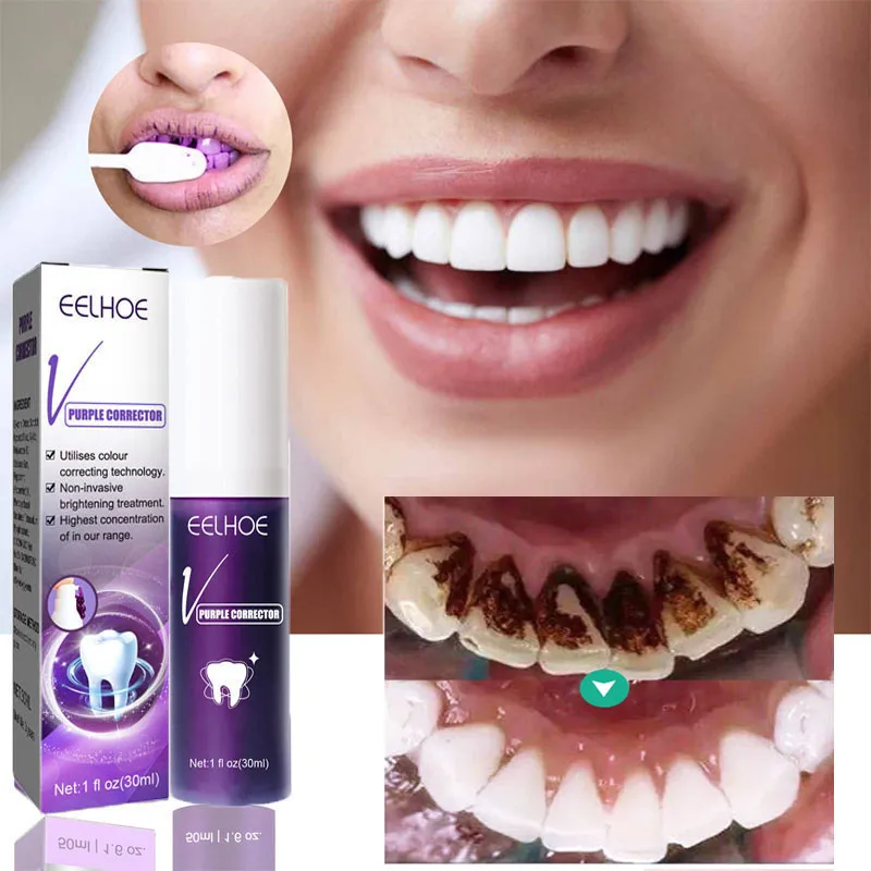 

Whitening Tooth Toothpaste Oral Cleaning Remove Plaque Smoke Stains Freshen Breath Effectively Removal Yellow Teeth Dental Care