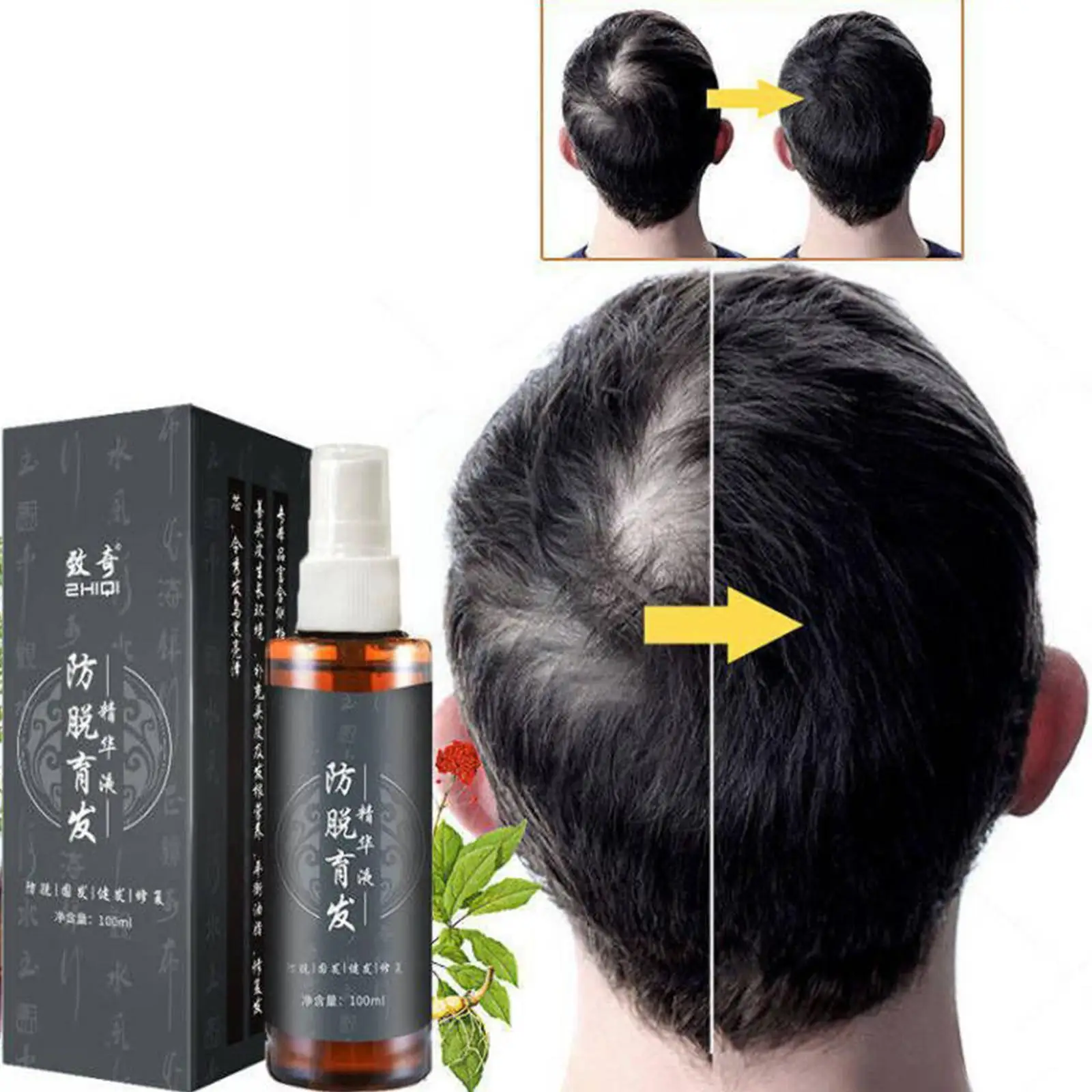 Масло для быстрого роста кожи головы B3Q6, 100 мл
Масло для быстрого роста кожи головы B3Q6, 100 мл