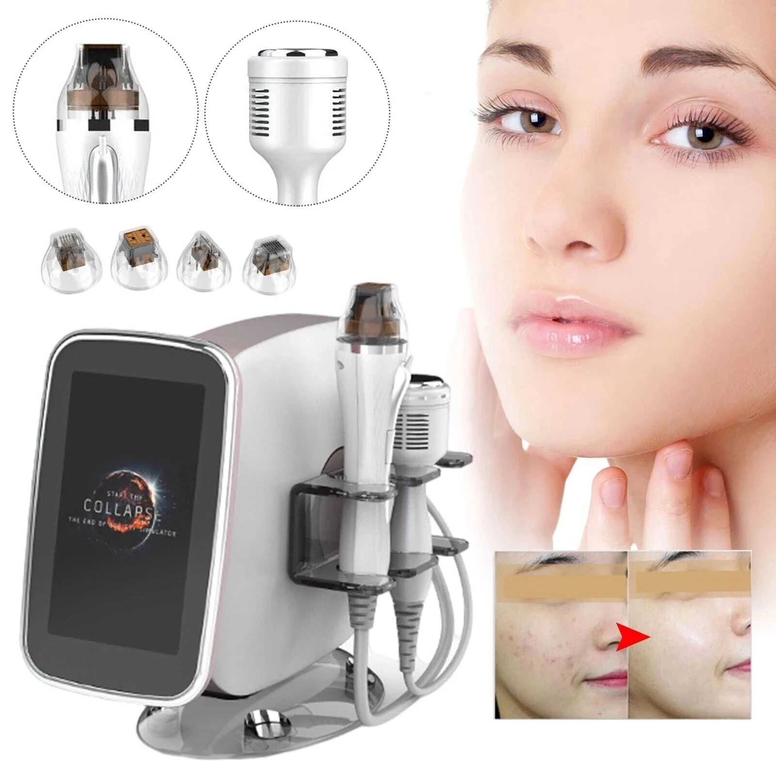 2023 new RF Nano Fractional Microneedle Machine 2 in 1 with Cold Hammer Frequency Skin Tightening Acne Scars Stretch Marks Remov
2023 new RF Nano Fractional Microneedle Machine 2 in 1 with Cold Hammer Frequency Skin Tightening Acne Scars Stretch Marks Remov