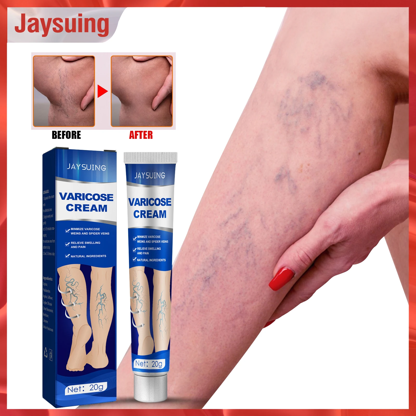 Jaysuing Varicose Vein Cream Repair Blood Vessel Bulging Treatment Swelling Earthworm Spider Inflammation Varicose Massage Cream
Jaysuing Varicose Vein Cream Repair Blood Vessel Bulging Treatment Swelling Earthworm Spider Inflammation Varicose Massage Cream