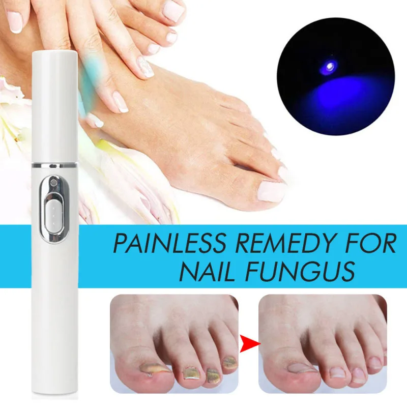 1pc Onychomycosis Laser Painless Anti Fungus Infection Fungal Removal Laser Onychomycosis Care Strong Grow Toe Nail Repair Tool
1pc Onychomycosis Laser Painless Anti Fungus Infection Fungal Removal Laser Onychomycosis Care Strong Grow Toe Nail Repair Tool