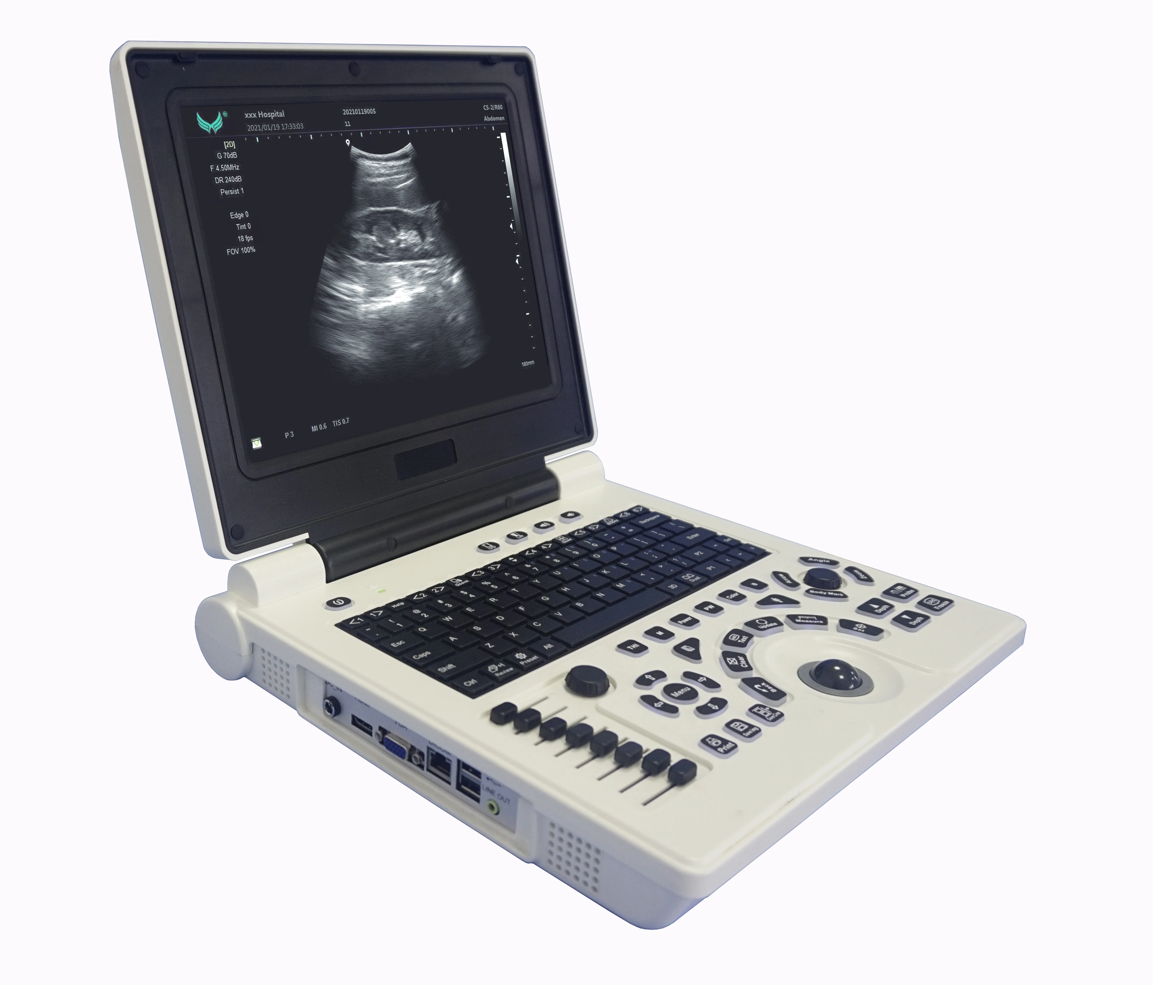 new arrival P20 PW black and white ultrasound scanner supports convex,transvaginal,linear and micro convex
new arrival P20 PW black and white ultrasound scanner supports convex,transvaginal,linear and micro convex