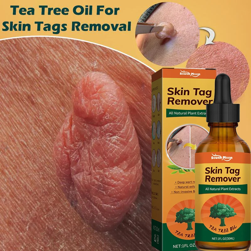 Skin Tag Remover Serum Painless Mole Skin Dark Spot Warts Treatment Freckle Flat Wart Genitals Beauty Herbal Essential Oil 30ml
Skin Tag Remover Serum Painless Mole Skin Dark Spot Warts Treatment Freckle Flat Wart Genitals Beauty Herbal Essential Oil 30ml