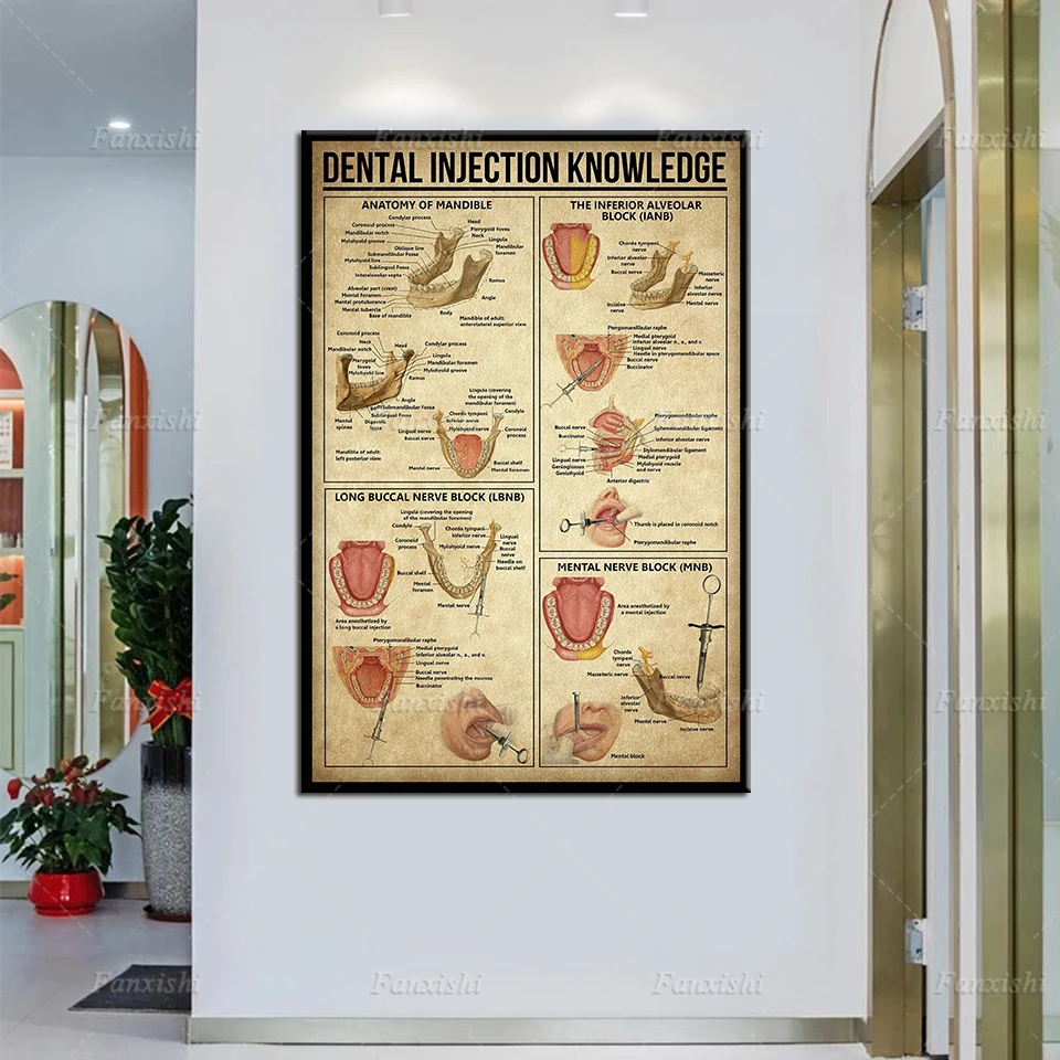 Vintage Dental Injection Knowledge Painting Posters And Prints On Canvas Retro Wall Art Modular Pictures Decoration Dentist Gift
Vintage Dental Injection Knowledge Painting Posters And Prints On Canvas Retro Wall Art Modular Pictures Decoration Dentist Gift