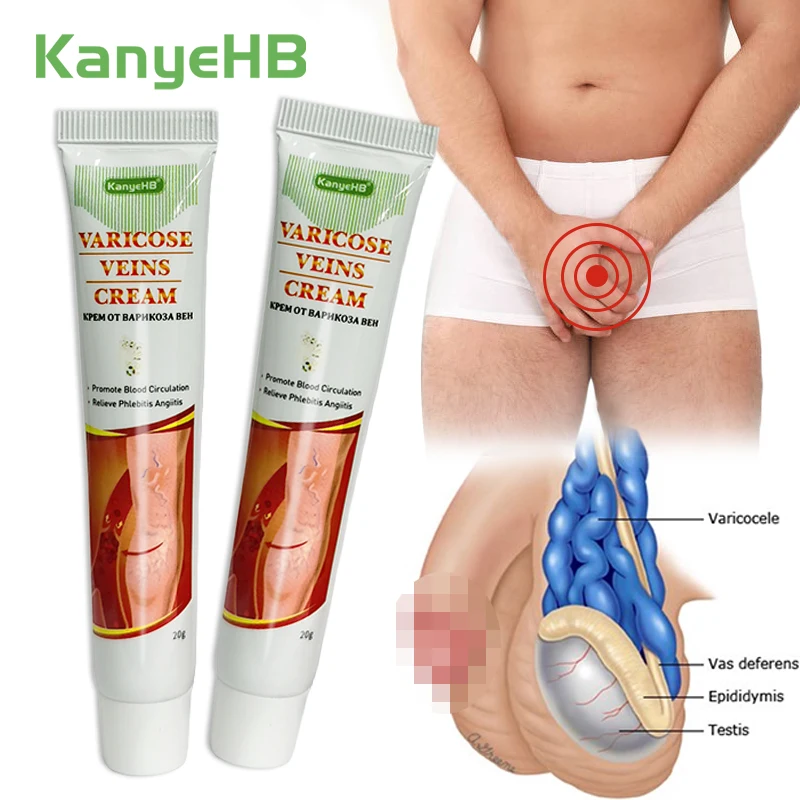 2Pcs Chinese Varicose Veins Cream Vasculitis Phlebitis Spider Leg Treatment Medical Cream Varicocele Angiitis Removal Cream A640
2Pcs Chinese Varicose Veins Cream Vasculitis Phlebitis Spider Leg Treatment Medical Cream Varicocele Angiitis Removal Cream A640