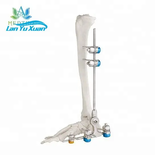 Ортопедический внешний фиксатор для наружной фиксации голеностопных суставов
Ортопедический внешний фиксатор для наружной фиксации голеностопных суставов