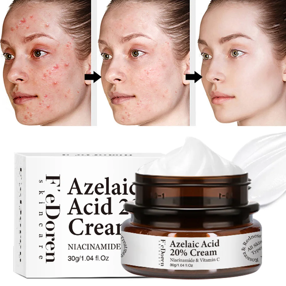 Azelaic Acid 20% Facial Cream Remove Dark Spots Acne Fine Lines Whiten Skin Face Moisturizing Cream Skin Care
Azelaic Acid 20% Facial Cream Remove Dark Spots Acne Fine Lines Whiten Skin Face Moisturizing Cream Skin Care