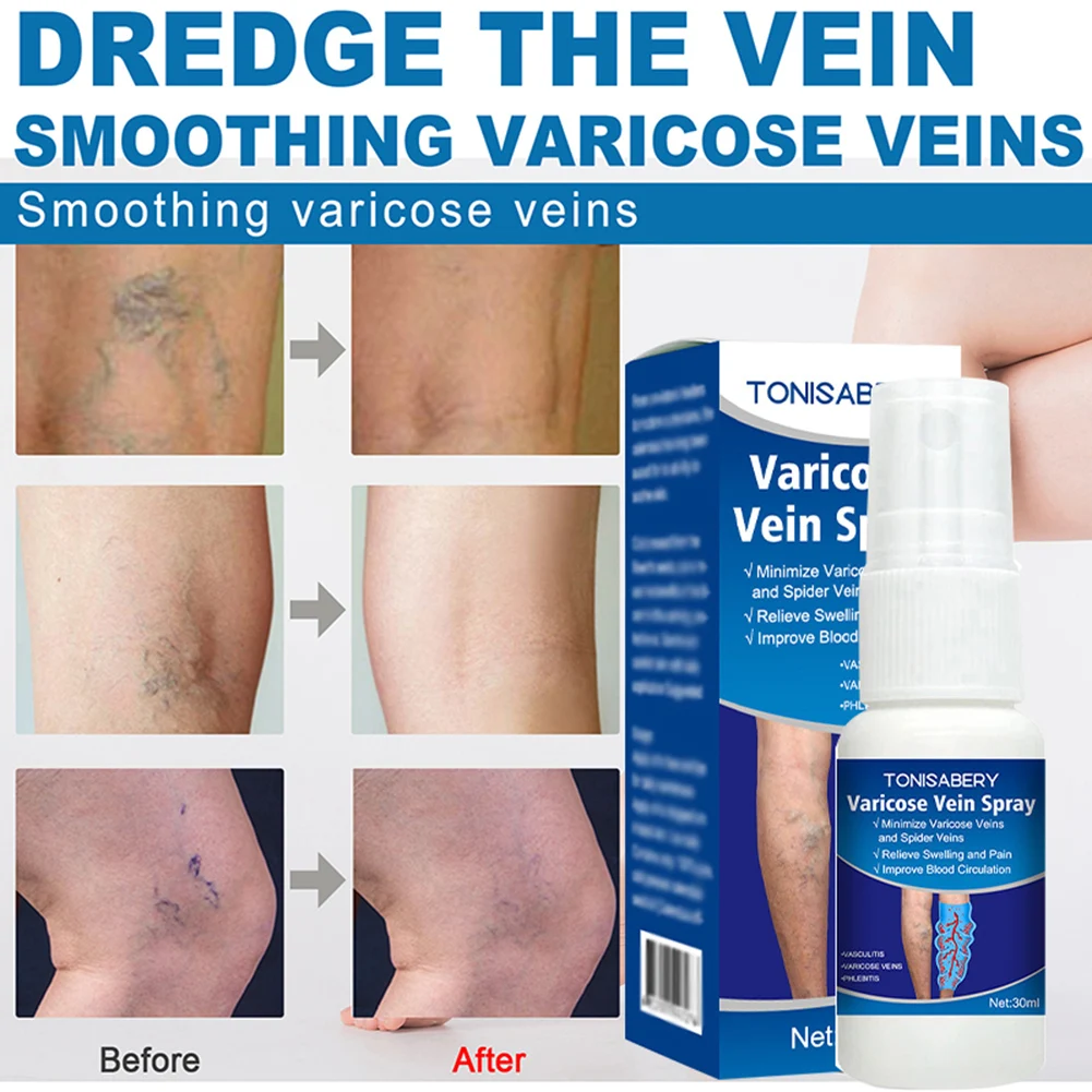 30ml Varicose Vein Spray Vasculitis Phlebitis Spider Legs Soothing Spray Blood Vessel Bulging Pain Relief Healthy Body Care
30ml Varicose Vein Spray Vasculitis Phlebitis Spider Legs Soothing Spray Blood Vessel Bulging Pain Relief Healthy Body Care