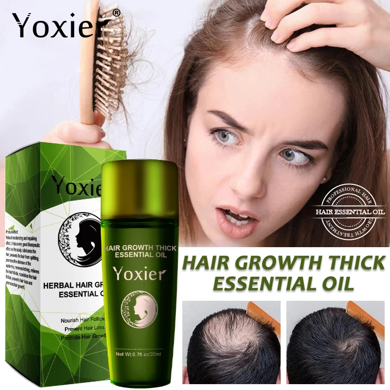 Ginger Hair Growth Products Prevent Hair Loss Essential Oil Fast Growing Scalp Treatment Beauty Health For Men Women 20ml
Ginger Hair Growth Products Prevent Hair Loss Essential Oil Fast Growing Scalp Treatment Beauty Health For Men Women 20ml