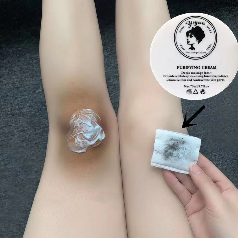 Remove Melanin Pigmentation Fast Whitening Cream For Private Parts Knuckle Elbows Stains Remover Serum Anti Acanthosis Care
Remove Melanin Pigmentation Fast Whitening Cream For Private Parts Knuckle Elbows Stains Remover Serum Anti Acanthosis Care