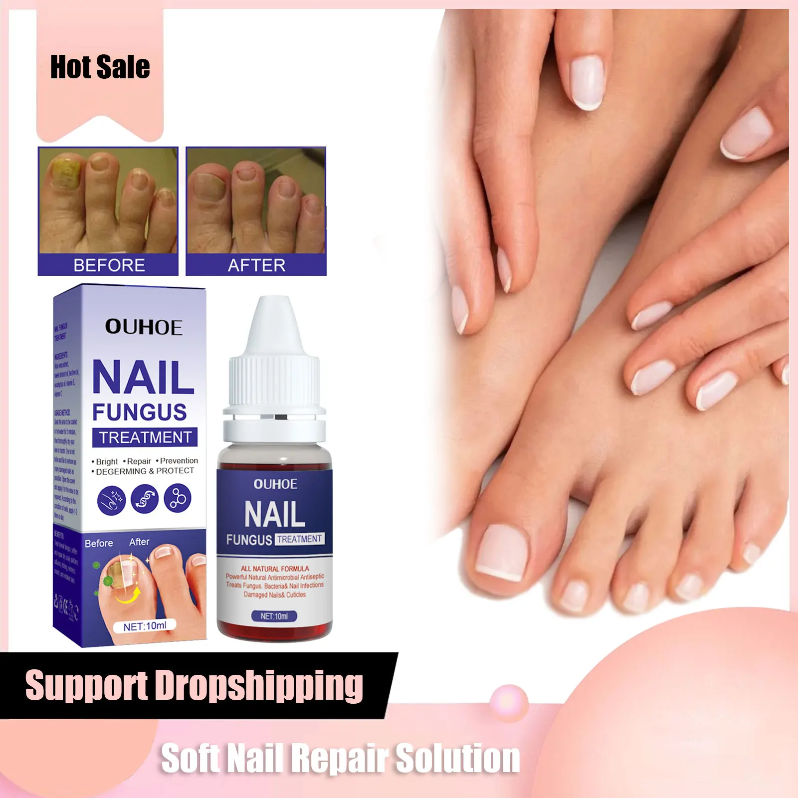Nail Repair Nutrient Solution Soften Infection Damage Nails Anti Onychomycosis Grey Nail Treatment Foot Fungus Removal Solution
Nail Repair Nutrient Solution Soften Infection Damage Nails Anti Onychomycosis Grey Nail Treatment Foot Fungus Removal Solution
