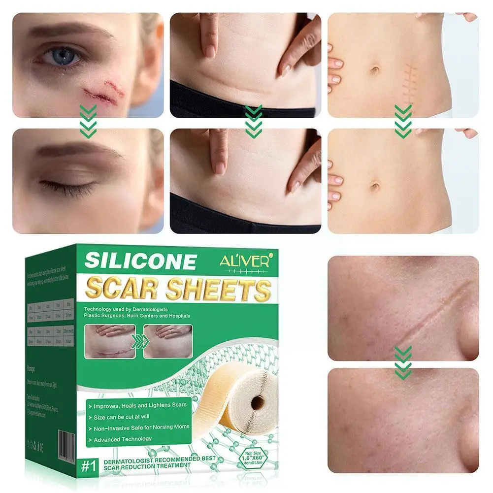 4*150cm Surgery Scar Removal Silicone Gel Patch Treatment Tape Burn Therapy Repair Acne Sheet Tools Trauma Efficient Skin S X0i8
4*150cm Surgery Scar Removal Silicone Gel Patch Treatment Tape Burn Therapy Repair Acne Sheet Tools Trauma Efficient Skin S X0i8