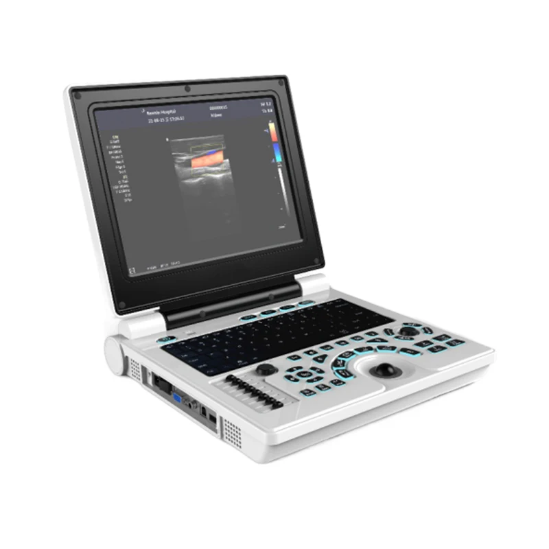 MY-A024N 12 Inch LCD Flat Screen Laptop Color Doppler Ultrasound Scanner Ultrasonido Portatil
MY-A024N 12 Inch LCD Flat Screen Laptop Color Doppler Ultrasound Scanner Ultrasonido Portatil