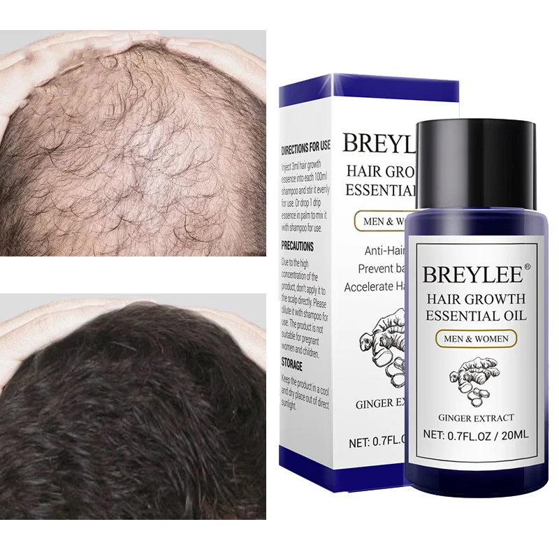 BREYLEE Ginger Hair Growth Essential Oil Anti Hair Loss Fast Grow Serum Repair Dry Frizzy Damaged Nourish Scalp Treatments 20ml 
BREYLEE Ginger Hair Growth Essential Oil Anti Hair Loss Fast Grow Serum Repair Dry Frizzy Damaged Nourish Scalp Treatments 20ml