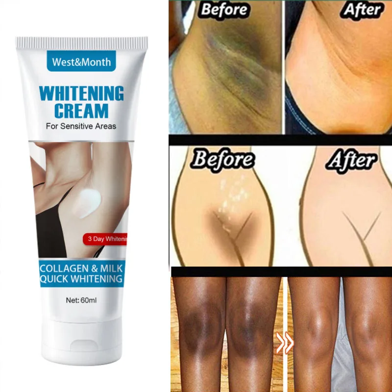 Body Whitening Cream Underarms Knees Hip Removal Melanin Private Bleaching Improves Dullness Brightening Moisturizing Skin Care
Body Whitening Cream Underarms Knees Hip Removal Melanin Private Bleaching Improves Dullness Brightening Moisturizing Skin Care