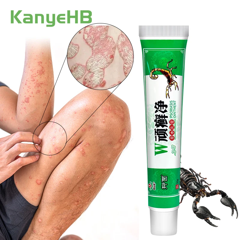1pcs Psoriasis Antibacterial Cream Scorpion Venom Curing Dermatitis Tinea Pedis Eczema Chinese Medicine Anti-Itch Ointment S091
1pcs Psoriasis Antibacterial Cream Scorpion Venom Curing Dermatitis Tinea Pedis Eczema Chinese Medicine Anti-Itch Ointment S091