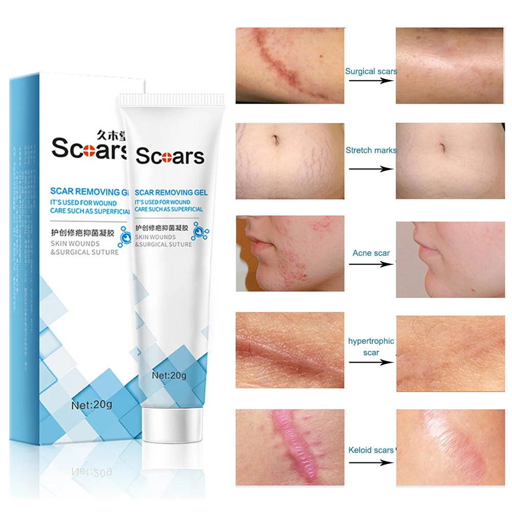 1/2PCS Fade Stretch Mark Gel Mini Portable Herb Repairing Surgical Scar Cream Convenient Multifunctional Moisturizing Skin Care
1/2PCS Fade Stretch Mark Gel Mini Portable Herb Repairing Surgical Scar Cream Convenient Multifunctional Moisturizing Skin Care