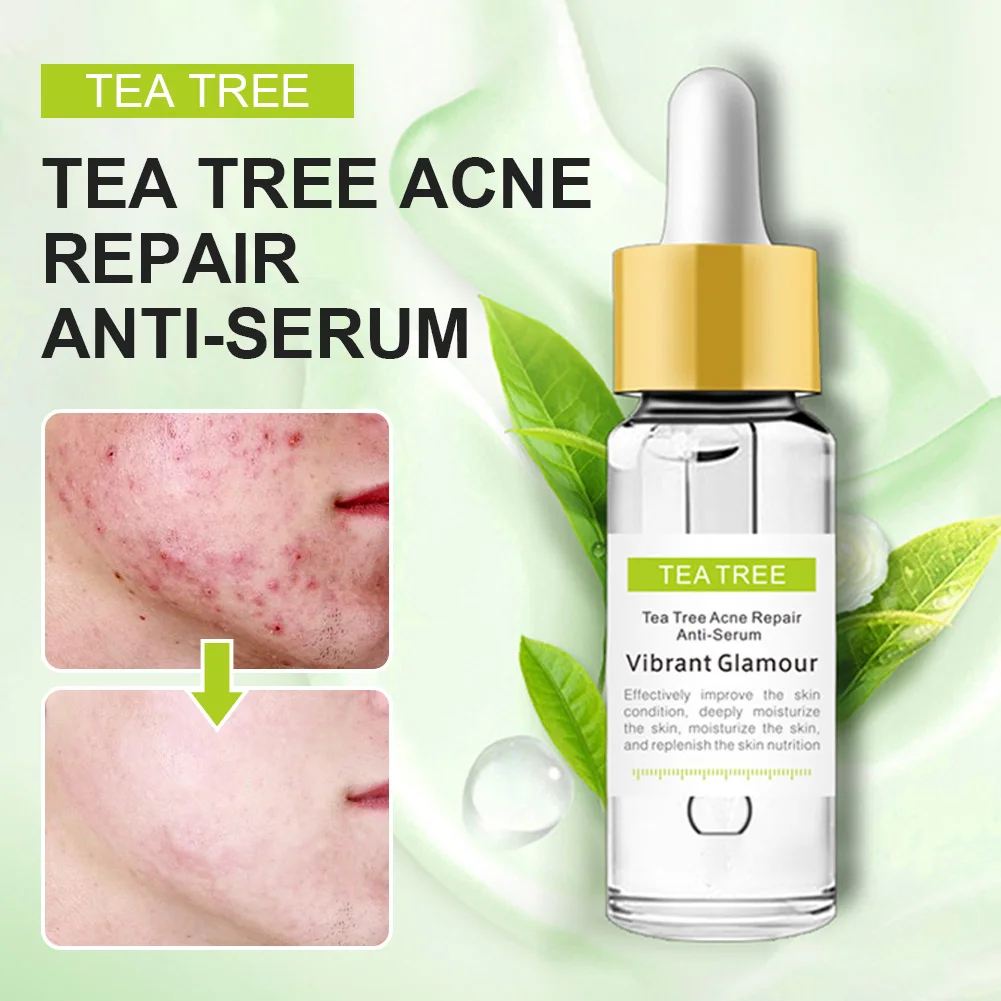 Tea Tree Acne Treatment Serum Remove Acne Pimples Shrink Pores Oil Control Skin Repairing Moisturizing Serum
Tea Tree Acne Treatment Serum Remove Acne Pimples Shrink Pores Oil Control Skin Repairing Moisturizing Serum