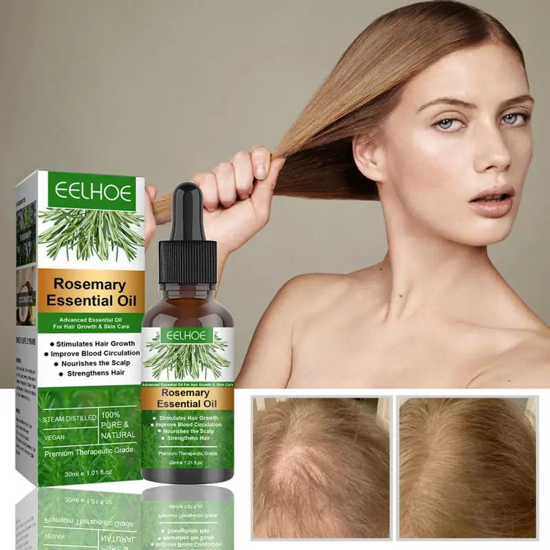 Sdotter Rosemary Hair Growth Serum Natural Anti Preventing Hair Loss Alopecia Liquid Damaged Hair Repair Growing For Men Women N
Sdotter Rosemary Hair Growth Serum Natural Anti Preventing Hair Loss Alopecia Liquid Damaged Hair Repair Growing For Men Women N