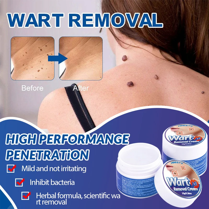 Effective Wart Remover Cream Plantar For Feet Warts Ointment For Neck Face Armpits Antibacterial Painless Skin Repair Body Care
Effective Wart Remover Cream Plantar For Feet Warts Ointment For Neck Face Armpits Antibacterial Painless Skin Repair Body Care