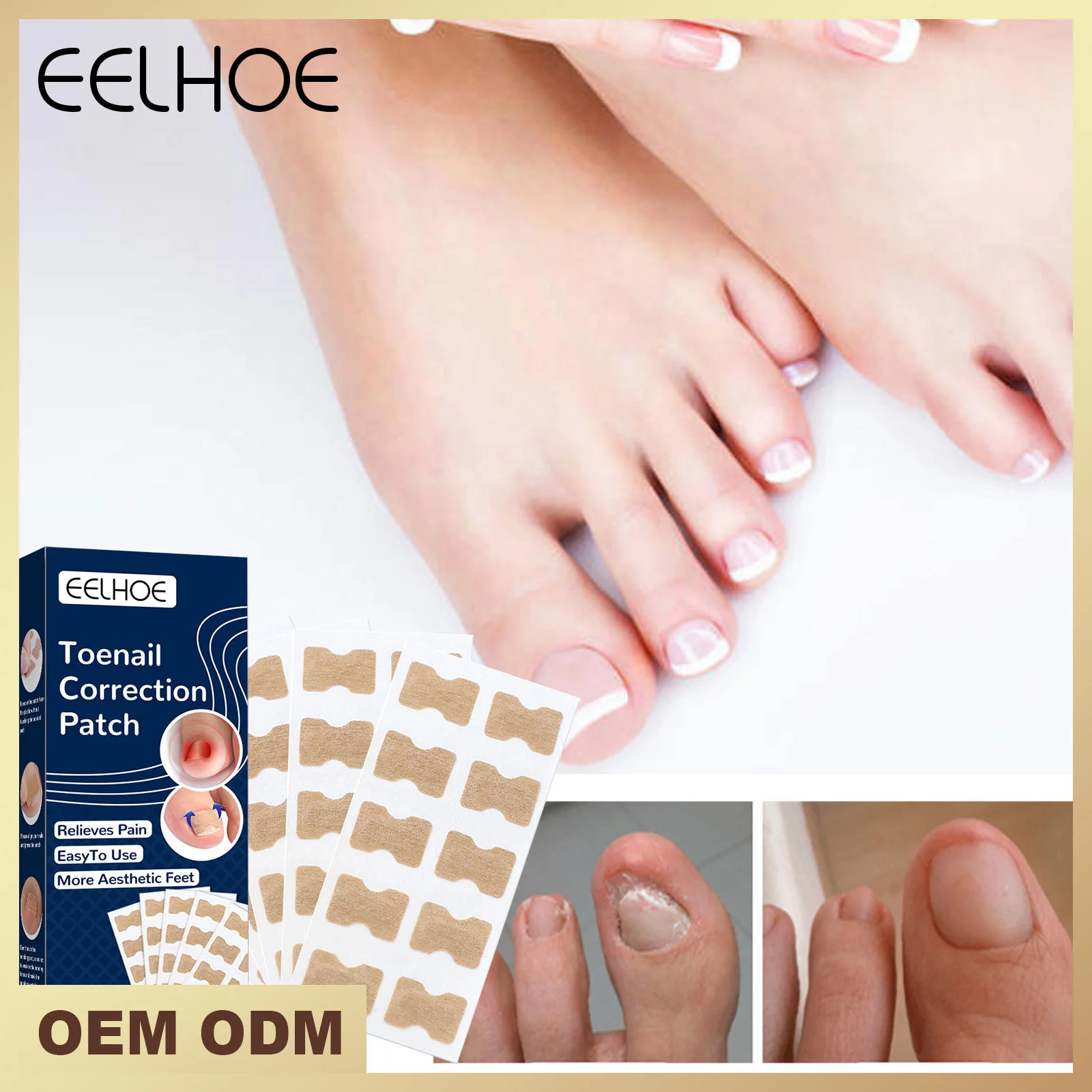 Ingrown Toenail Corrector Sticker Nail Strip Anti-roll Nail Free Glue Toe Inlay Nail Corrector Patch Correction Stickers Toenail
Ingrown Toenail Corrector Sticker Nail Strip Anti-roll Nail Free Glue Toe Inlay Nail Corrector Patch Correction Stickers Toenail