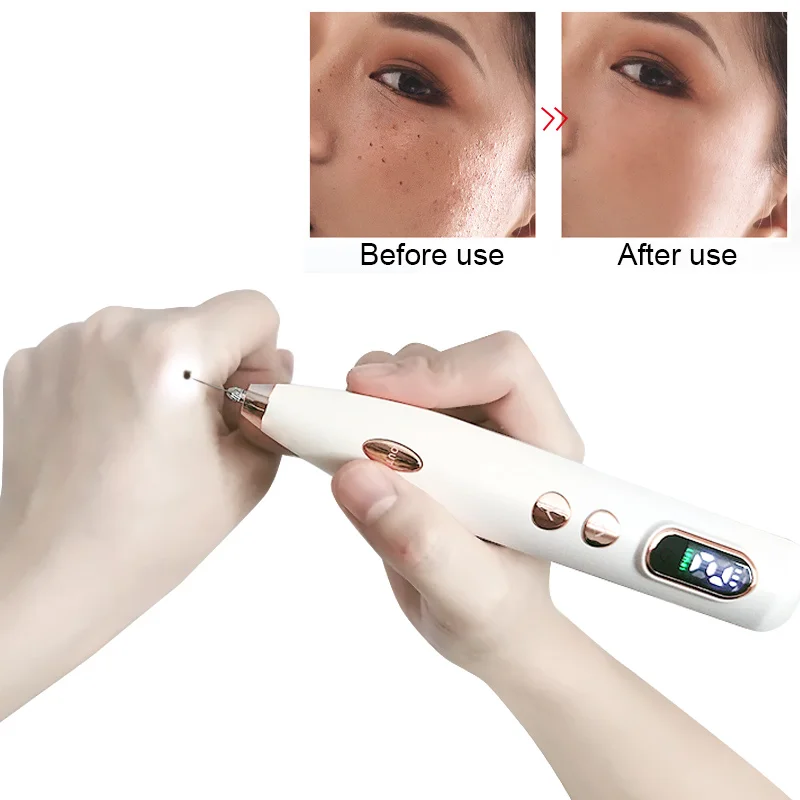 Face Cleaning Beauty Tools LCD Laser Plasma Pen Profesional Skin Tag Tattoo Black Dot Blackhead Remover puntero laser Skin Care
Face Cleaning Beauty Tools LCD Laser Plasma Pen Profesional Skin Tag Tattoo Black Dot Blackhead Remover puntero laser Skin Care