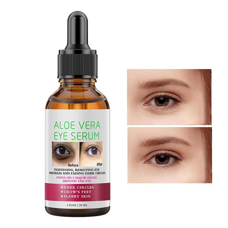 Освежитель для глаз с экстрактом алоэ
Освежитель для глаз с экстрактом алоэ