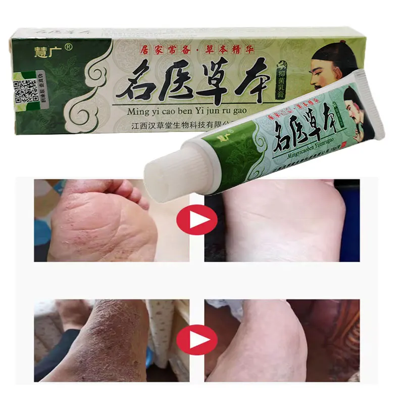 

Psoriasis Eczma Cream Natural Anti-Itch Eczematoid Urticaria Body Skin Treatment Herbal Ointment Antibacterial Gel Against
