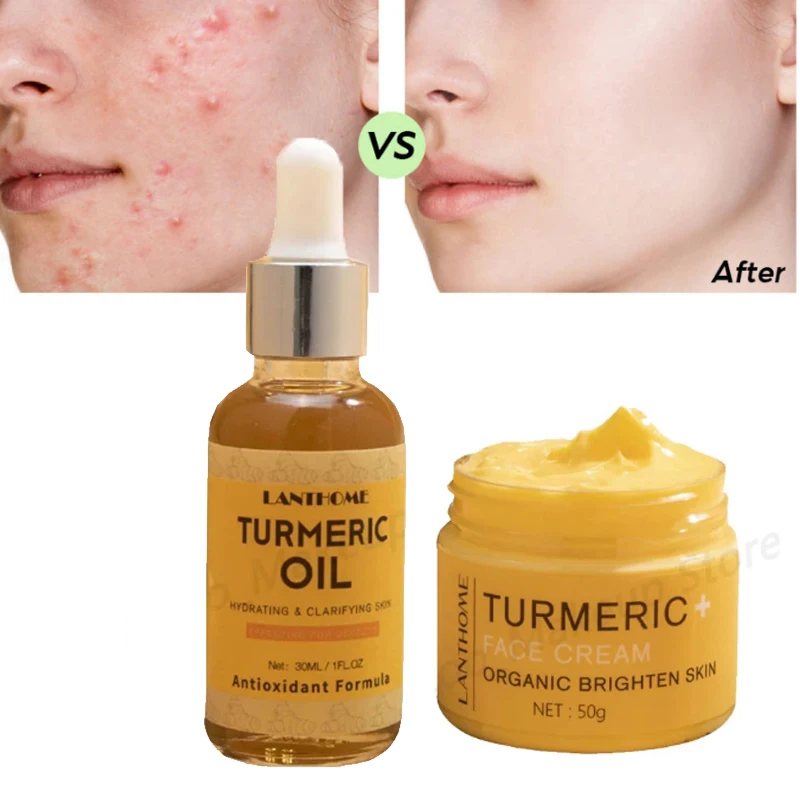 2 шт./набор, сыворотка для ухода за кожей лица
2 шт./набор, сыворотка для ухода за кожей лица