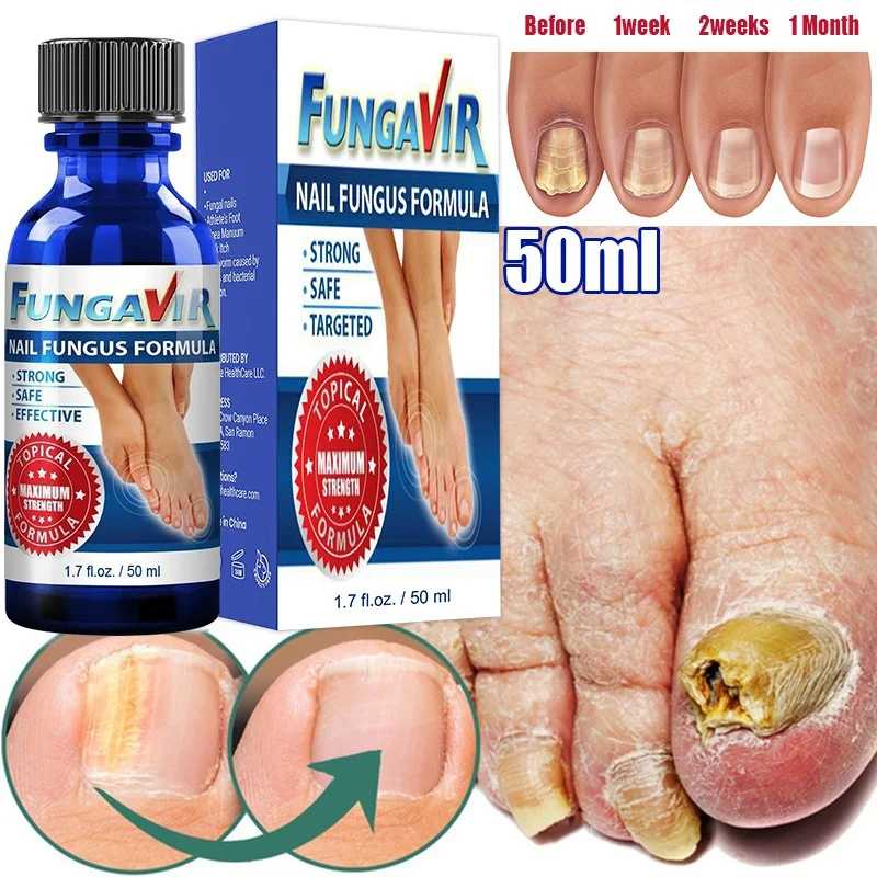 2022 Best Nail Repair Stop Fungal Growth Effective Fingernail & Toenail Health Care Solution Fix & Renew Damaged Cracked & Dis
2022 Best Nail Repair Stop Fungal Growth Effective Fingernail & Toenail Health Care Solution Fix & Renew Damaged Cracked & Dis