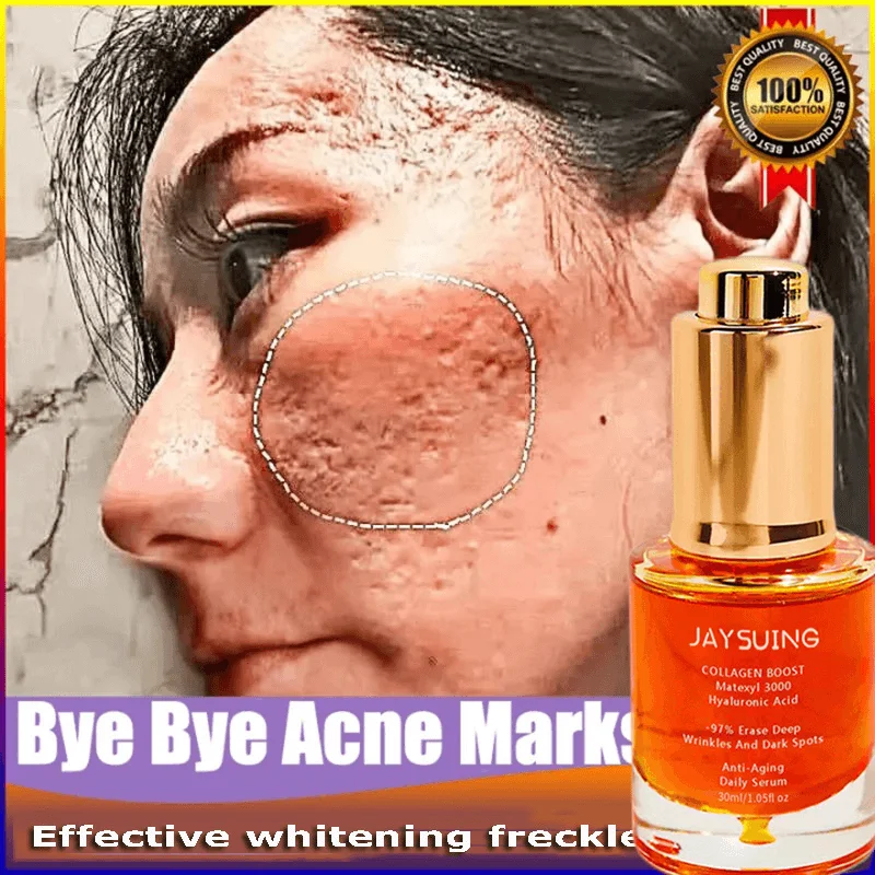 

Instant Wrinkle Freckles Remover Face Serum Fade Dark Spots Fine Lines Lift Firm Anti-aging Essence Skin Care Whitening Brighten