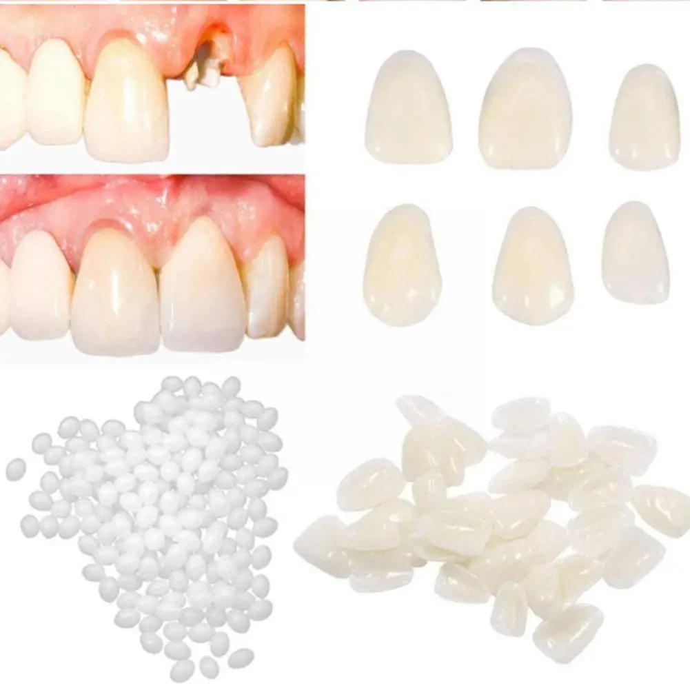 

Смола 5g/10g/1 5g/20g, набор для временного ремонта зубов, клей для отбеливания зубов, косметические зазоры, клей для зубов, зубы FalseTeeth So N6P2