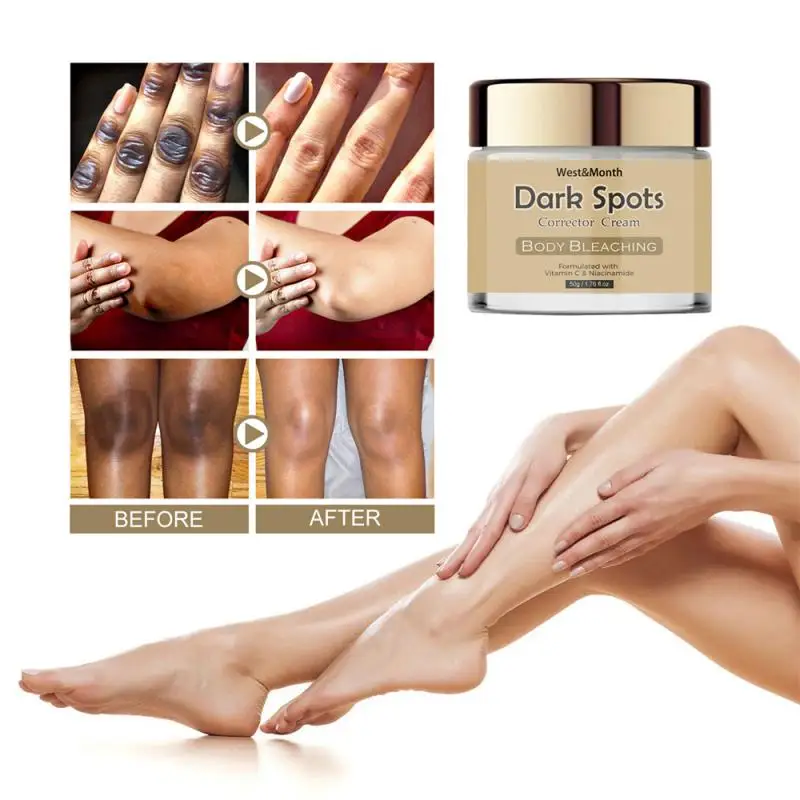 

Body Whitening Cream Arms Thighs Underarm Knees Whitening Essence Cream Brighten Moisturizing Body Korean Skin Care Products 30g