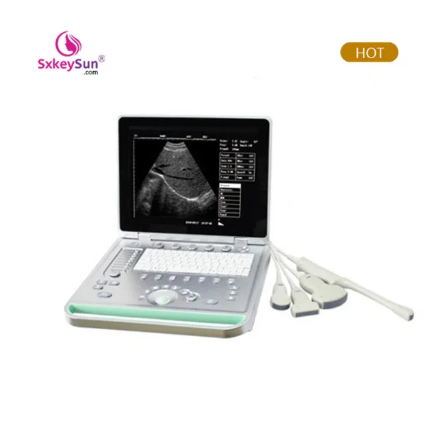 2020 Portable Color Ultrasound scanner ultrasound ultrasonic phased array flaw detector Portable Ultrasonic Diagnostic Devices
2020 Portable Color Ultrasound scanner ultrasound ultrasonic phased array flaw detector Portable Ultrasonic Diagnostic Devices