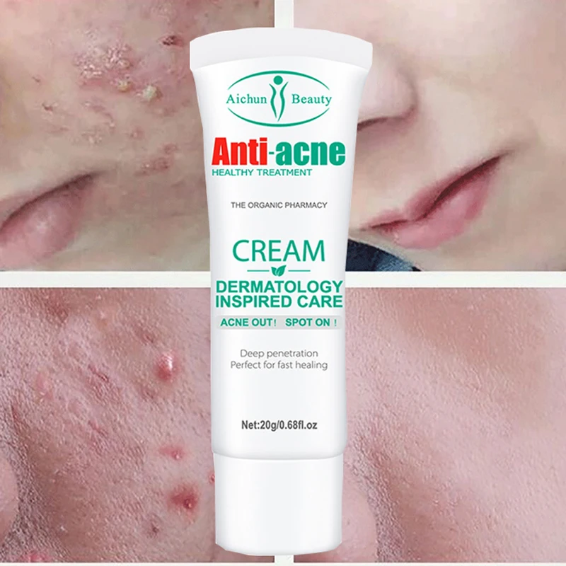 Крем для удаления прыщей и шрамов от прыщей, 20 г
Крем для удаления прыщей и шрамов от прыщей, 20 г