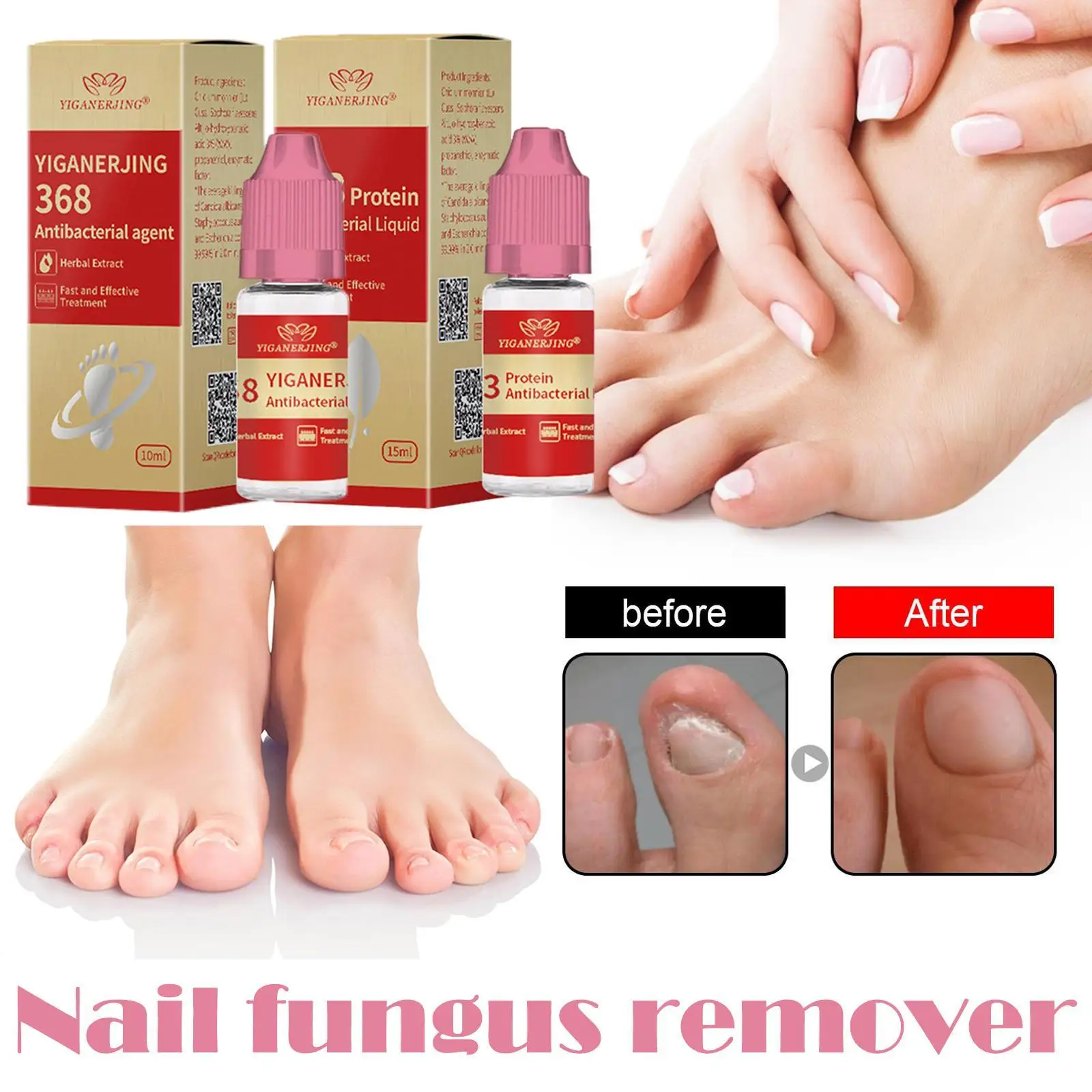 10/15ml Fungal Nail Liquid Antibacterial Agent Foot Toes Anti Infection Paronychia Onychomycosis Nail Fungus Removal Essence
10/15ml Fungal Nail Liquid Antibacterial Agent Foot Toes Anti Infection Paronychia Onychomycosis Nail Fungus Removal Essence