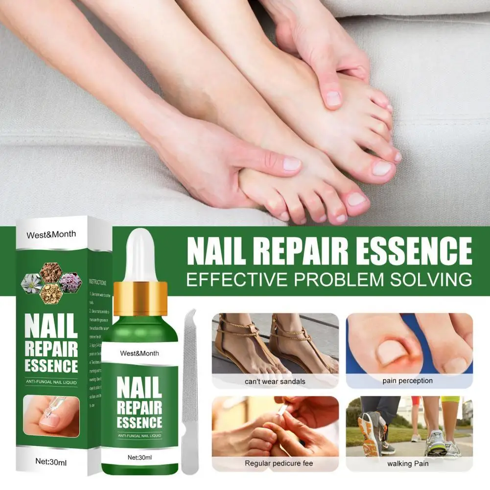 1 Set Nail Repair Liquid Fast Absorption Nourishing Mild Ingredients Toes Paronychia Onychomycos Fungus Remove Serum for Adult
1 Set Nail Repair Liquid Fast Absorption Nourishing Mild Ingredients Toes Paronychia Onychomycos Fungus Remove Serum for Adult