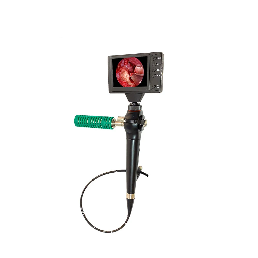 LTEG28 ENT Flexible Endoscope Portable Video Nasopharyngoscope / Bronchoscope / Cystoscope / Hysteroscope
LTEG28 ENT Flexible Endoscope Portable Video Nasopharyngoscope / Bronchoscope / Cystoscope / Hysteroscope