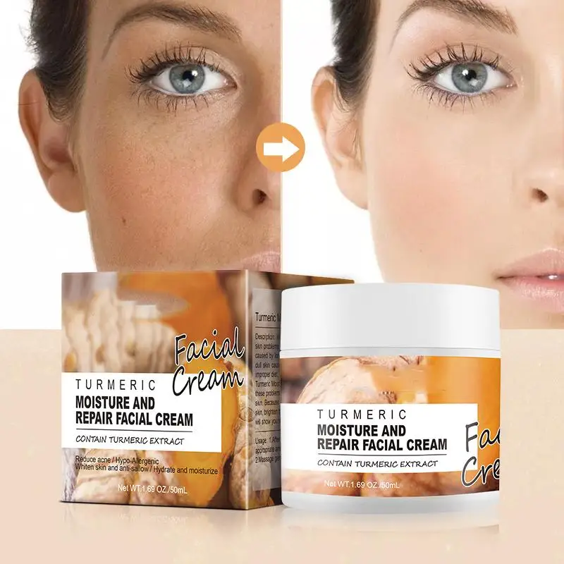 Turmeric Facial Skin Repair Cream Acne Treatment Face Moisturizer Whitening Lightening Against Acne Remover Cream
Turmeric Facial Skin Repair Cream Acne Treatment Face Moisturizer Whitening Lightening Against Acne Remover Cream