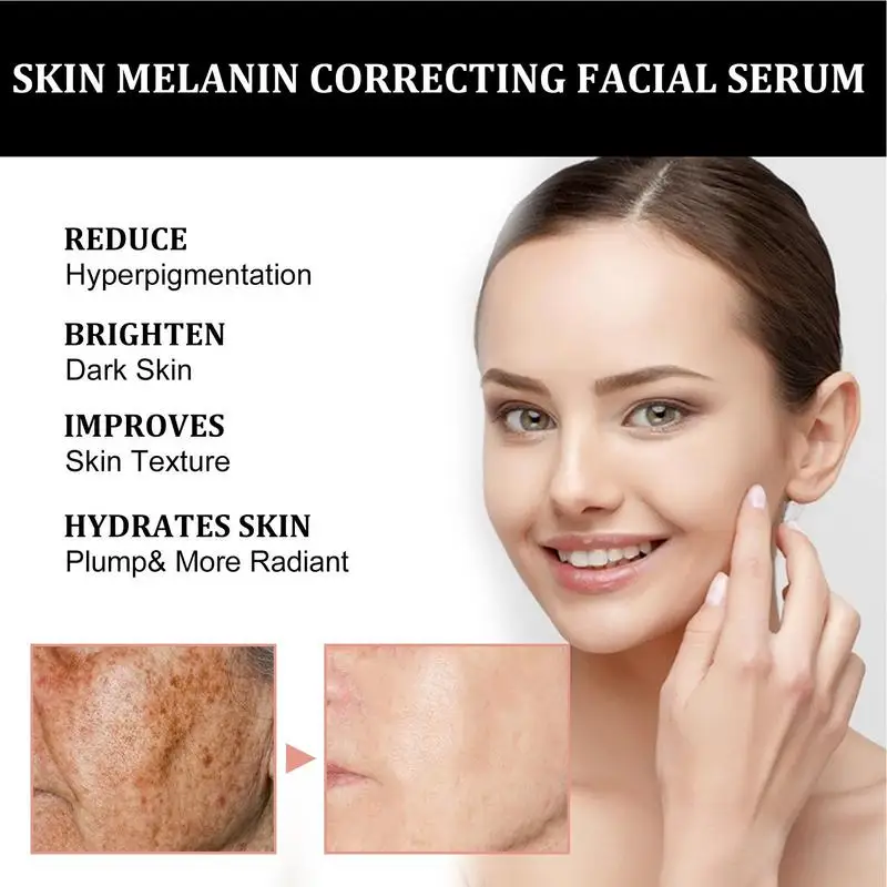 

Whitening Serum Fade Dark Spot Freckle Brighten Essence Remove Pigment Melanin Correcting Beauty Face Skin Care Korea Cosmetic