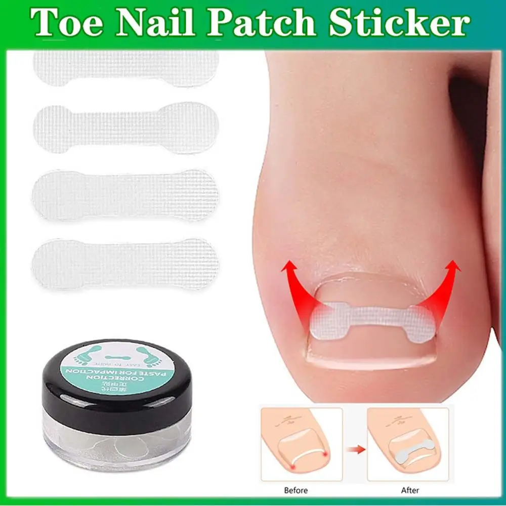 Pedicure patch Orthotic Nail Correction Tablets Toenail Ortho Sticker Correction Sticker Ingrown Toenails Stickers
Pedicure patch Orthotic Nail Correction Tablets Toenail Ortho Sticker Correction Sticker Ingrown Toenails Stickers