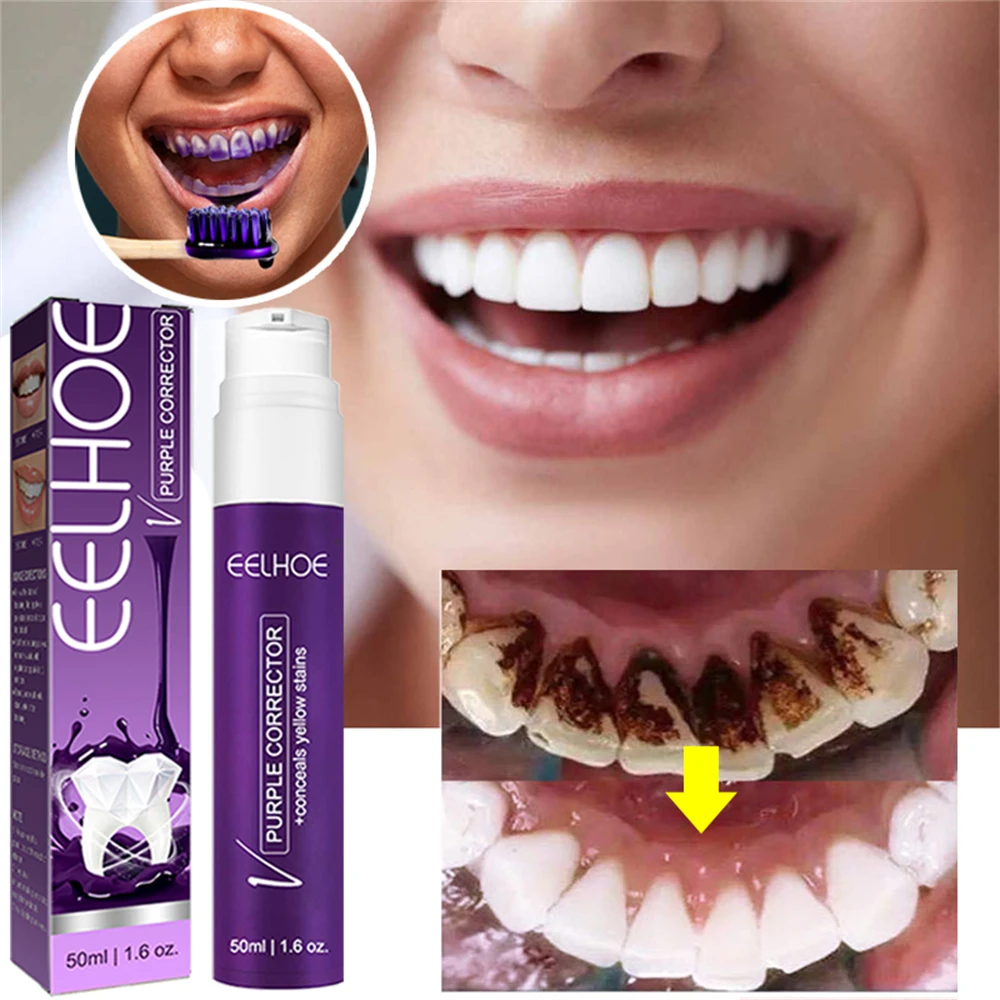 

Зубная паста фиолетовая для безопасного отбеливания, Освежающая пена для дыхания и чистки зубов, мусс для удаления зубного налета, средство для ухода за зубами, 50 мл