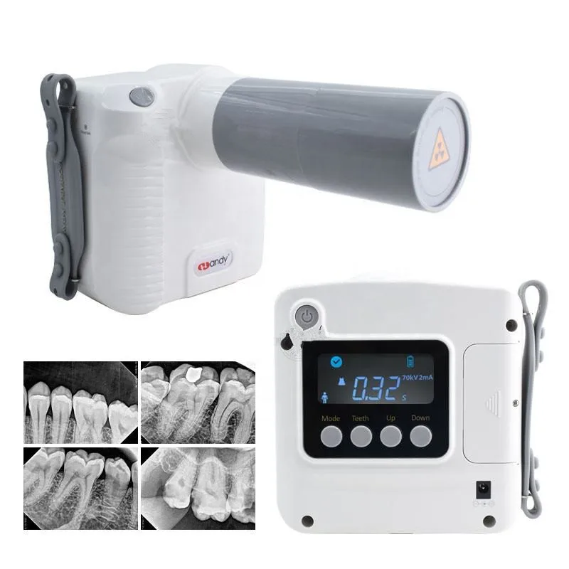 Wireless High Frequency Portable Handy Portable Dental X Ray Camera X Ray Camera Machine Full Mouth Dental X-ray Camera
Wireless High Frequency Portable Handy Portable Dental X Ray Camera X Ray Camera Machine Full Mouth Dental X-ray Camera