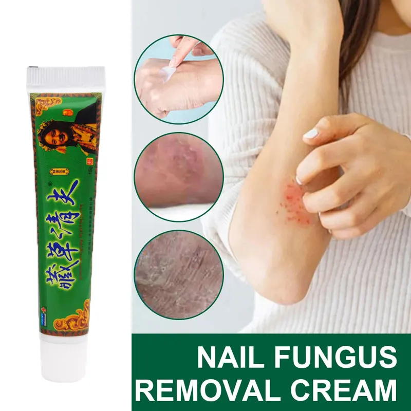 Psoriasis Dermatitis Eczematoid Eczema Ointment Treatment Cream for Children Adult 15g
Psoriasis Dermatitis Eczematoid Eczema Ointment Treatment Cream for Children Adult 15g