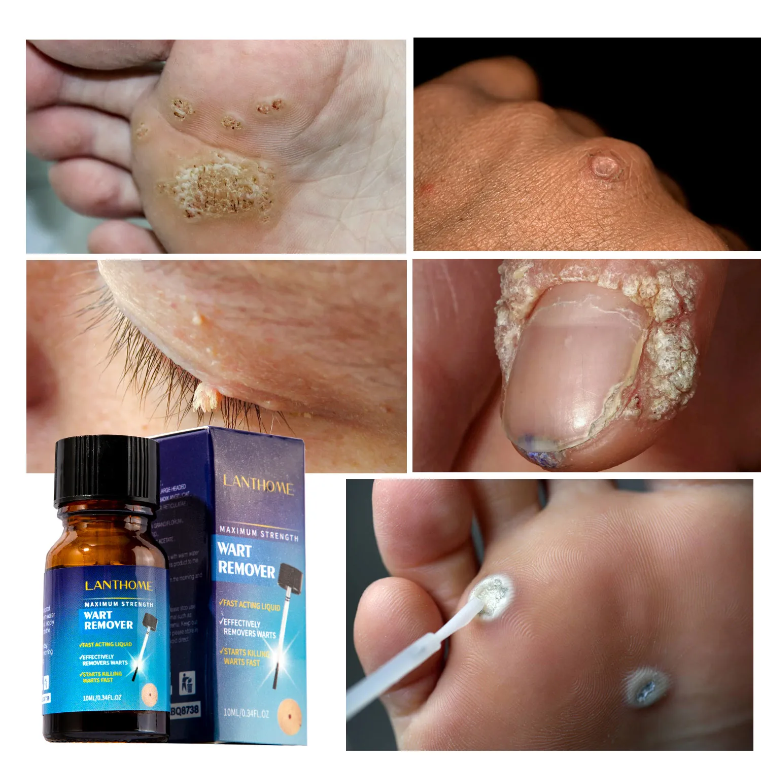 Skin Tag Remover Liquid Painless Mole Skin Dark Spot Warts Remover Serum Freckle Face Wart Tag Treatment Removal Essential Oil
Skin Tag Remover Liquid Painless Mole Skin Dark Spot Warts Remover Serum Freckle Face Wart Tag Treatment Removal Essential Oil
