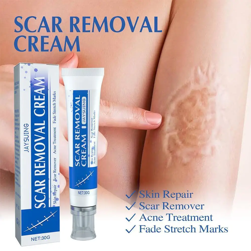 30g Scar Removal Cream Stretch Marks Removal Acne Scars Skin Repair Whitening Cream Dark Spot Remover For Face Skin Care 20 N6N0
30g Scar Removal Cream Stretch Marks Removal Acne Scars Skin Repair Whitening Cream Dark Spot Remover For Face Skin Care 20 N6N0